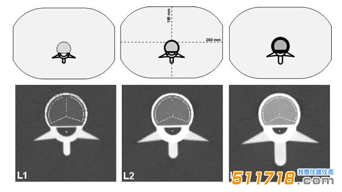 QRM-ESP 的 CT 圖像。椎體中段掃描圖像，并疊加了自動確定的松質骨和皮質骨 ROI。.png