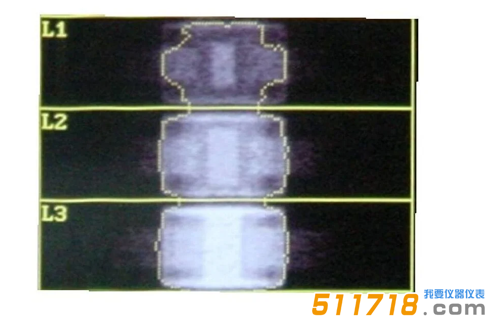 QRM-ESP 的 DXA 掃描（說明見以上文字） (1).png
